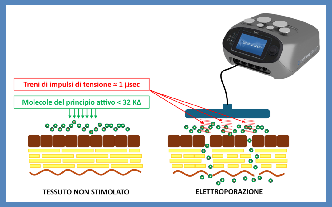 La veicolazione transdermica di principi attivi con la tecar