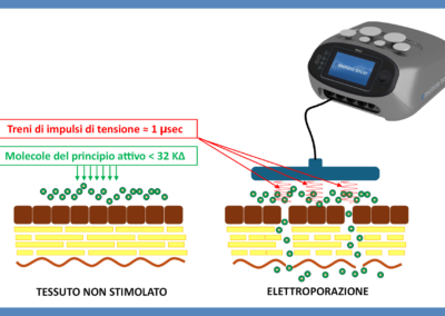 La veicolazione transdermica di principi attivi con la tecar
